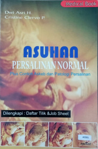 Asuhan persalinan normal